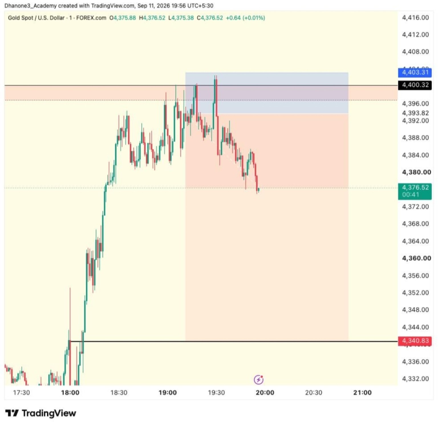 TRADE JOURNAL chart shared by DhanOne3